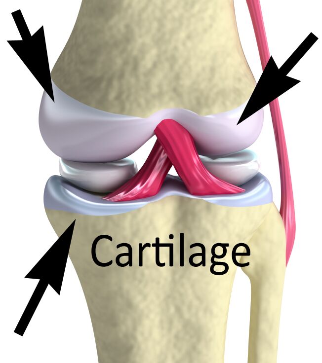 Difference Between Cartilage, Ligaments and Tendons